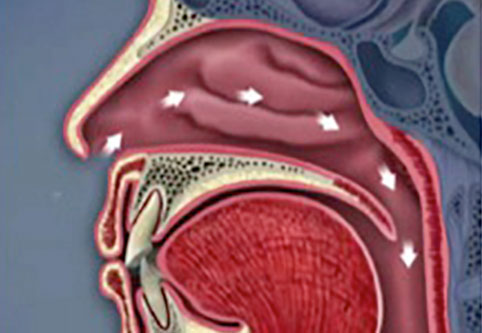 Nasal airway graphic